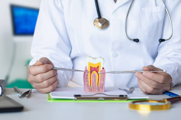 Best Emergency Wisdom Teeth Removal in Jacksonvle, IL