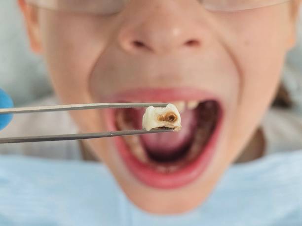 Best Cosmetic Emergency Dentistry in Jacksonvle, IL